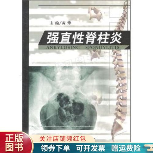 强直性脊柱炎吃柳氮磺和甲氨蝶呤