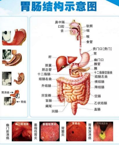 中医能治溃疡性结肠炎