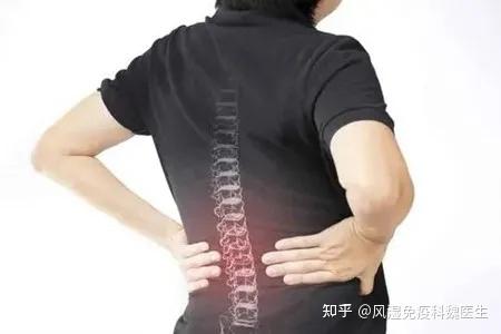 强直性脊柱炎是一侧疼还是两侧