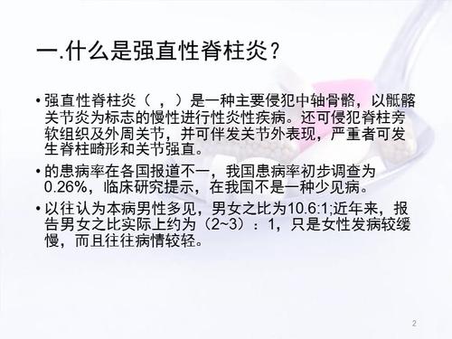 小活络丸治疗强直性脊柱炎效果