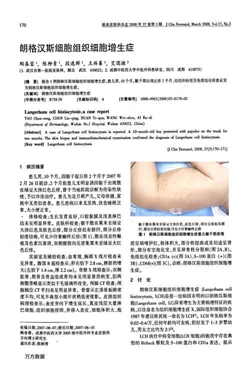 朗格汉斯组织细胞增生症