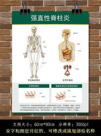 类风湿性强直性脊柱炎挂哪个科