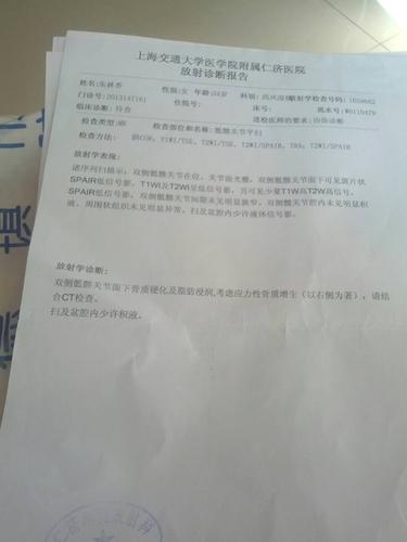 如何检查强直性脊柱炎