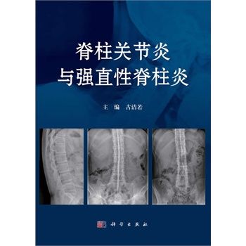 强直性脊柱炎同时吃两种药