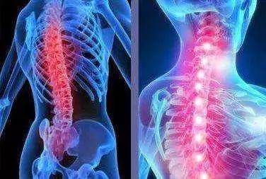 怎么治疗强直性脊柱炎最好
