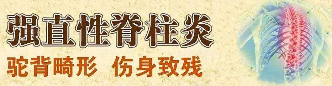强直性脊柱炎有用中药调理好的吗