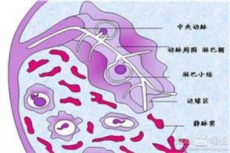 阵发性睡眠性血红蛋白尿