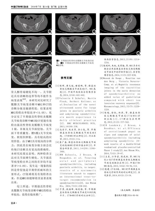 强直性脊柱炎拍ct还是mrt