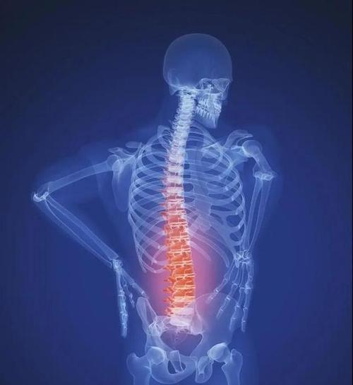 强直性脊柱炎为什么开始不发病