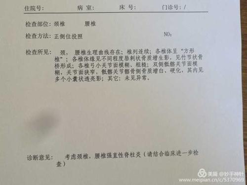 得了强直性脊柱炎公司能开除吗