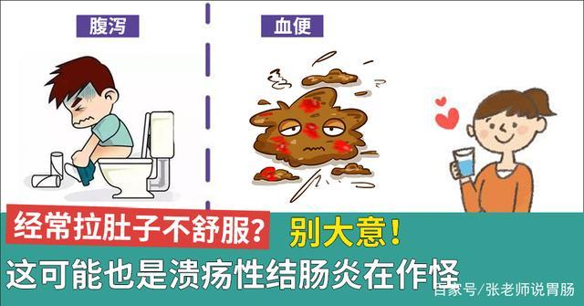 得了溃疡性结肠炎需要在饮食上注意什么