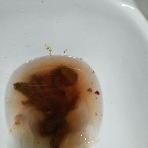 溃疡性结肠炎麦芽糊精
