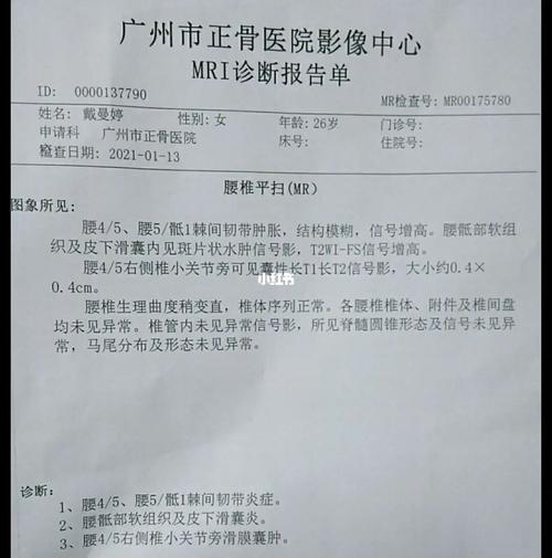 郑州有明治强直性脊柱炎医院