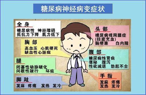 多灶性运动神经病