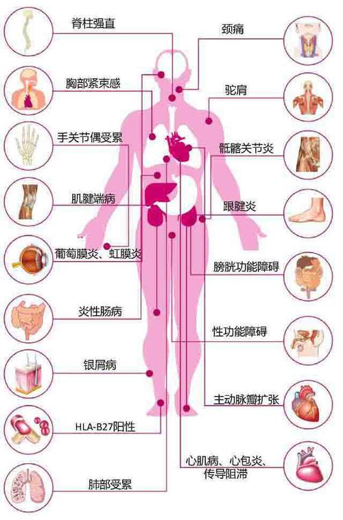 强直性脊柱炎能吃香芋吗