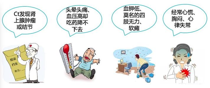 假性醛固酮增多症