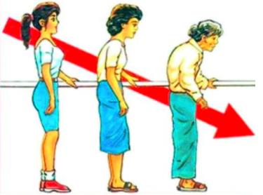 强直性脊柱炎是遗传病吗能否结婚