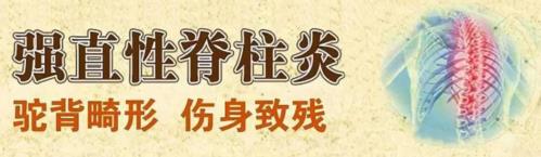 强直性脊柱炎吃什么好