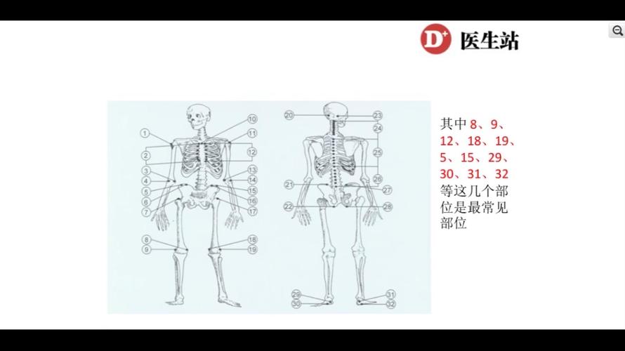 肠炎和强直性脊柱炎有关吗
