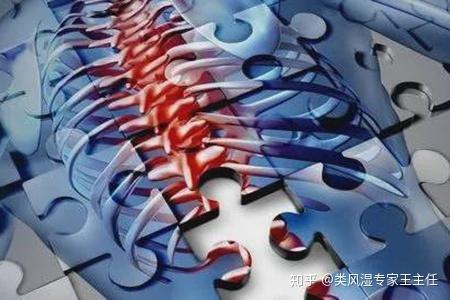 强直性脊柱炎的病人能吃狗肉吗