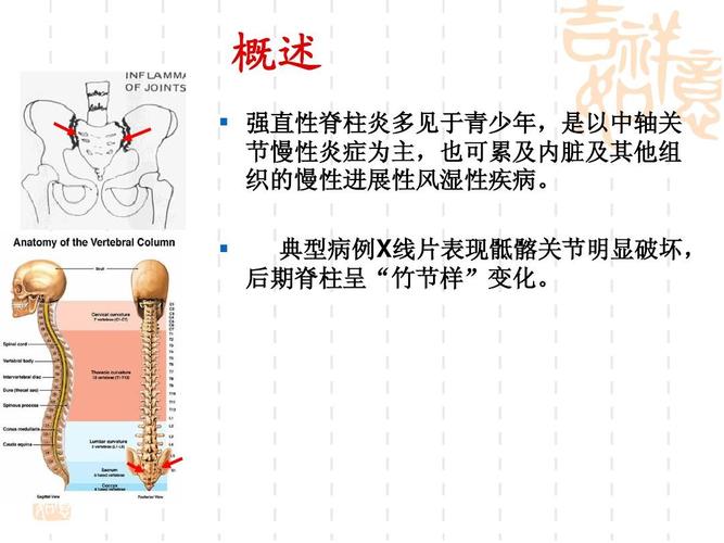 强直性脊柱炎慎用哪一种理疗