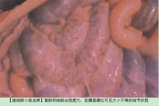 溃疡性结肠炎拉肚子有血