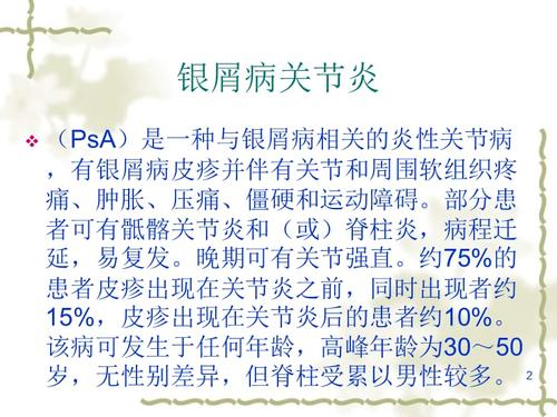 银屑病关节炎