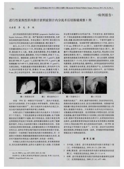 肝内胆汁淤积症