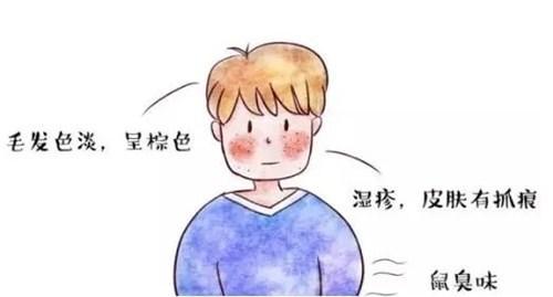 酪氨酸血症
