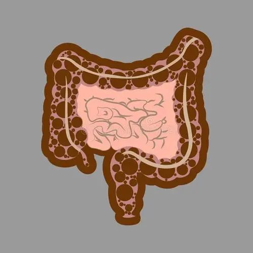 溃疡性结肠炎不出血小腹疼