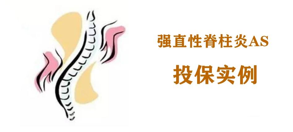 强直性脊柱炎家族性遗传病