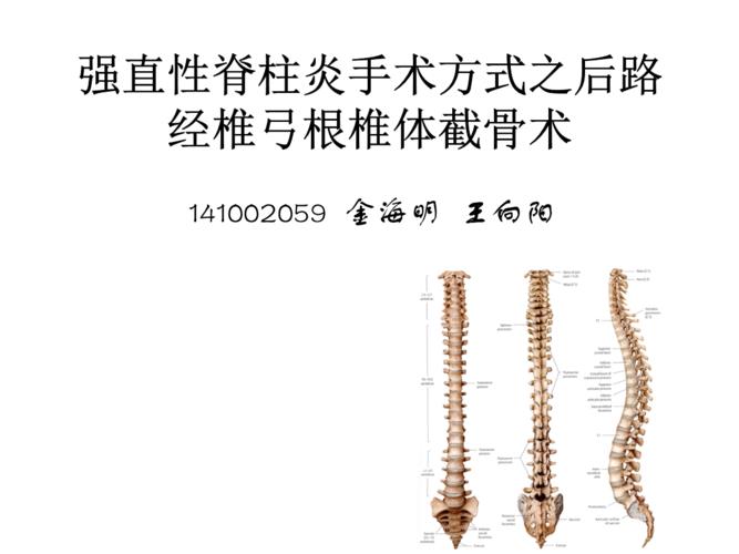 强直性脊柱炎椎体变化