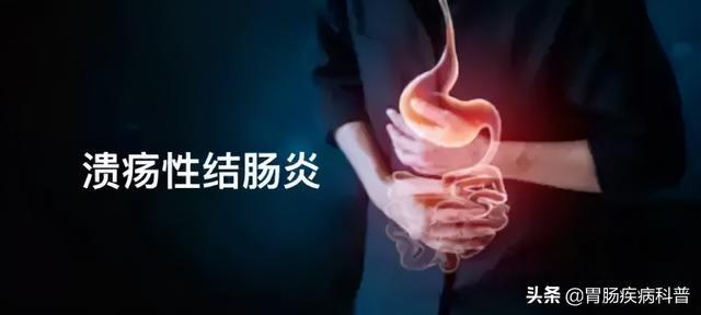中医溃疡性结肠炎的病因