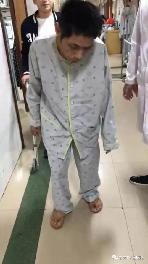 专业强直性脊柱炎治疗