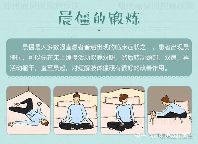 强直性脊柱炎怎么锻