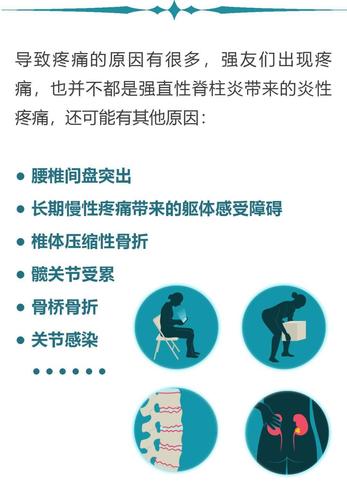 强直性脊柱炎输消炎药有效果吗