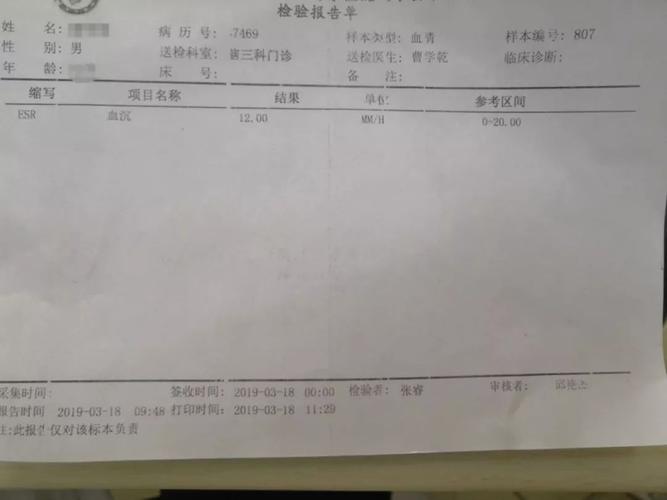 强直性脊柱炎扶他林软膏