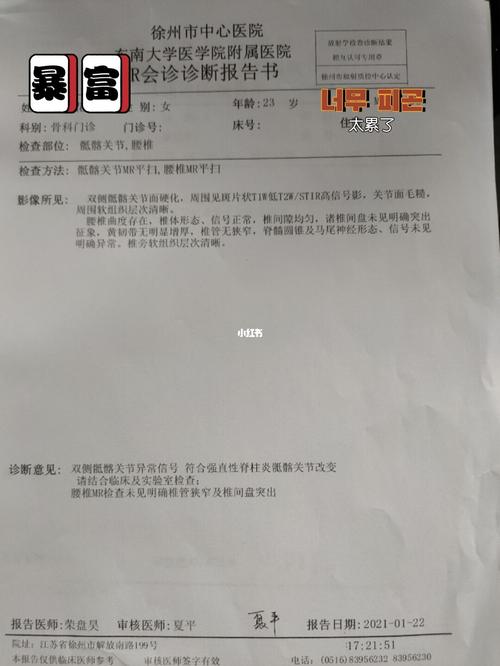 艾滋病和强直性脊柱炎有关系吗