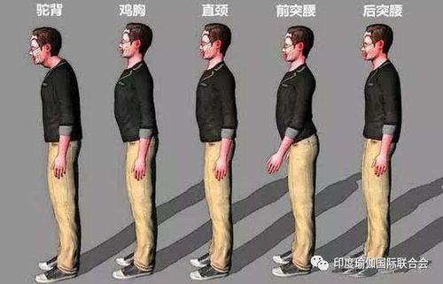 强直性脊柱炎查胸椎还是腰椎
