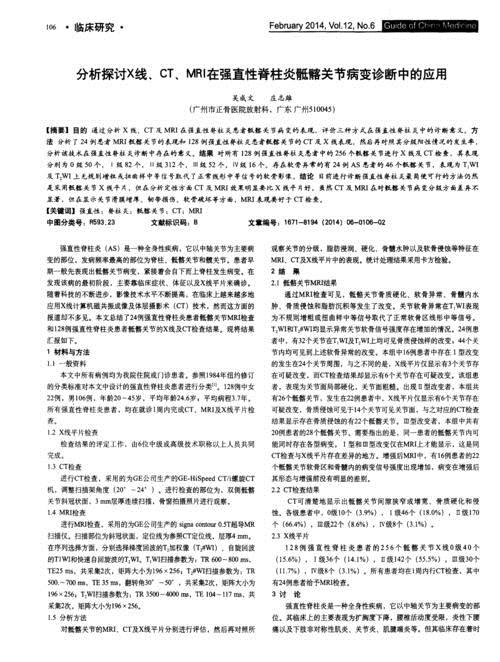 强直性脊柱炎的临床表
