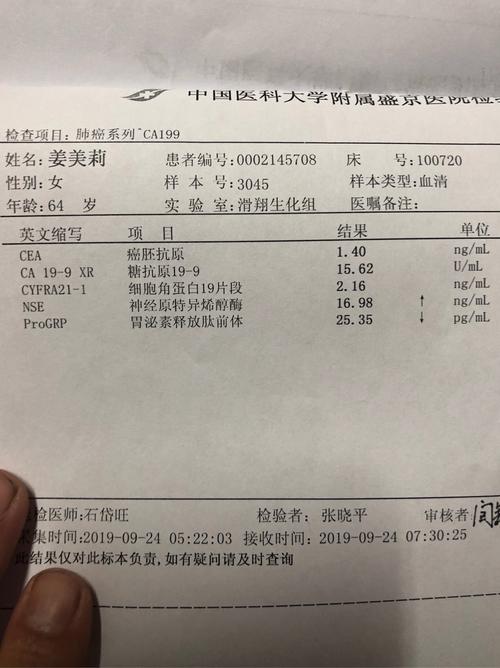 非霍奇金淋巴瘤