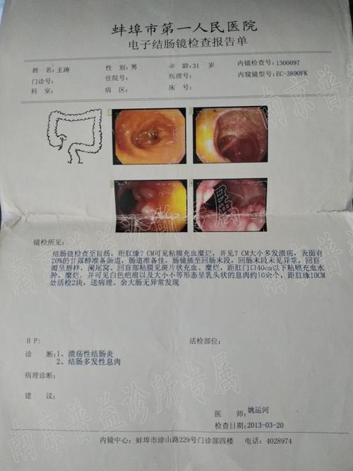 溃疡性结肠炎吃哪些营养粉