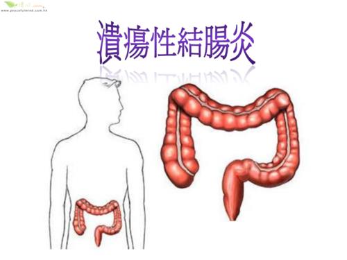 溃疡性结肠炎喝什么米糊好