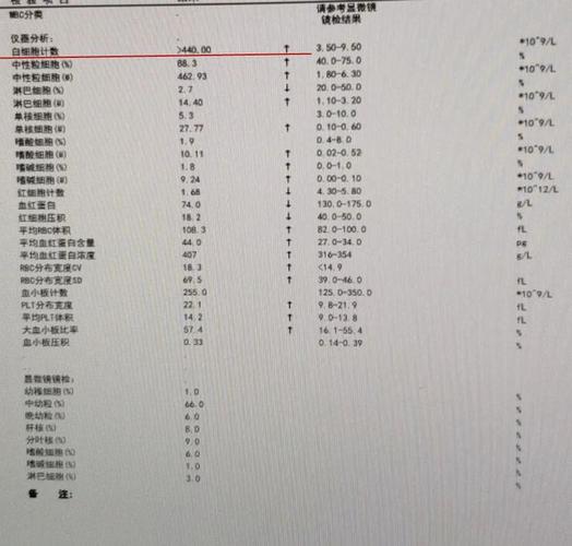 慢性粒细胞白血病