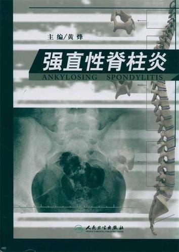 强直性脊柱炎只有白介素6高