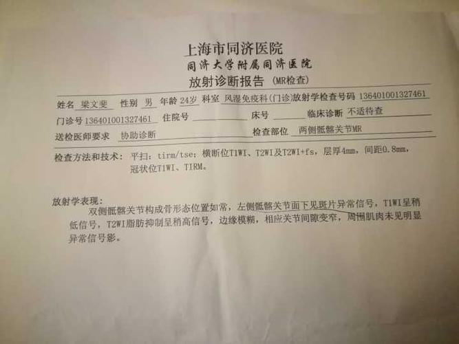 强直性脊柱炎怎么检查最快