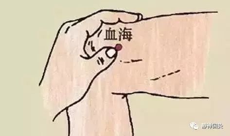 溃疡性结肠炎艾灸图片