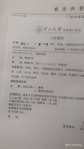 专门强直性脊柱炎的医院