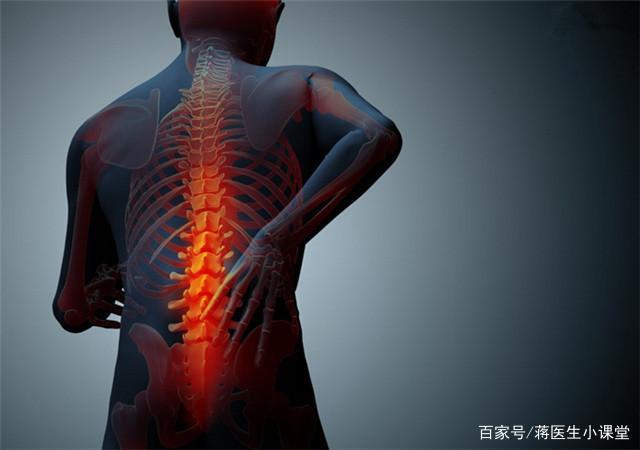 强直性脊柱炎禁忌姿势
