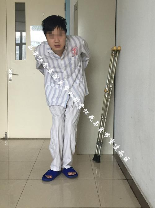 强直性脊柱炎的症状家庭好困难